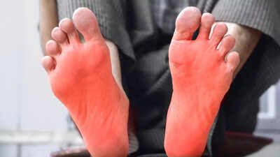 7 effective home remedies for burning feet: Simple ways to soothe pain and discomfort |