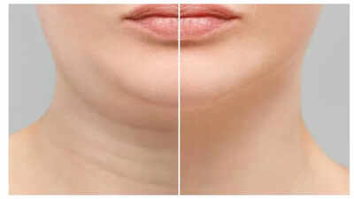 From heart health to diabetes risk: What neck size REVEALS about one’s overall health |