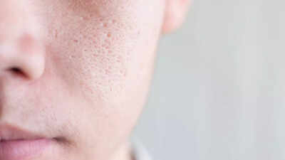 8 effective tips to reduce large pores for smoother skin |