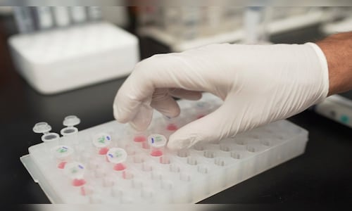 Ipca Labs to license cancer, autoimmune disorder drug to US firm BSS