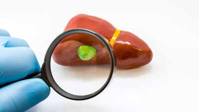 Diet to follow after gallbladder surgery: What to eat and avoid for easy digestion and recovery |