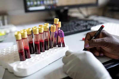 HIV jab for 115 nations rests on Indian regulators | India News