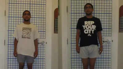 Limb lengthening surgery: The painful procedure adults are using to grow taller; what is it, risks, and recovery explained |