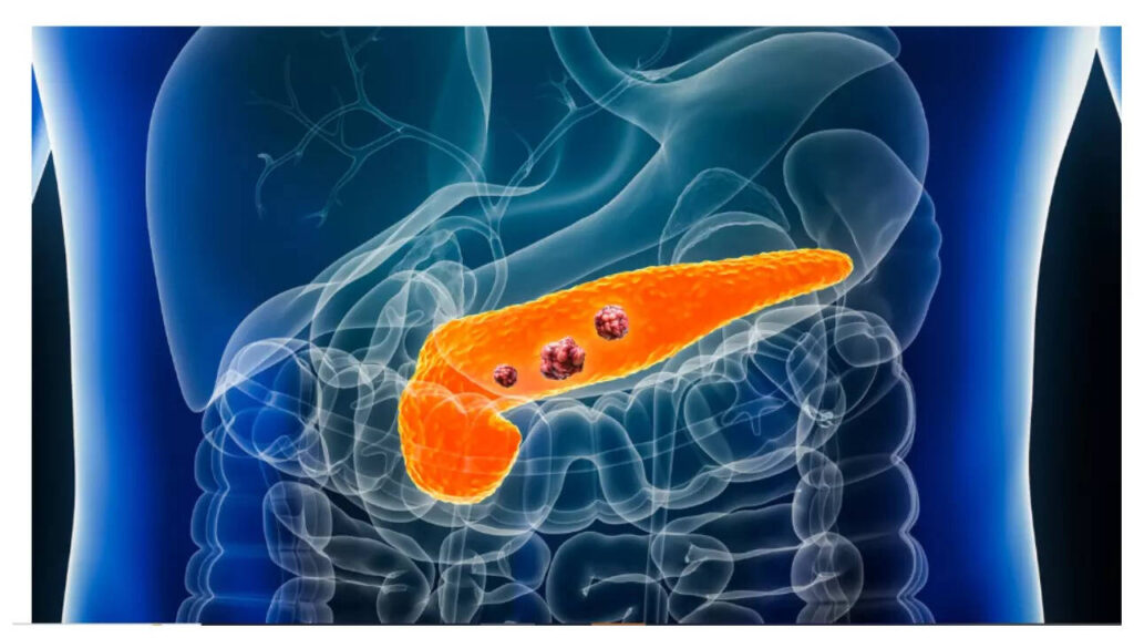 Early symptoms and 5 common habits that can trigger it