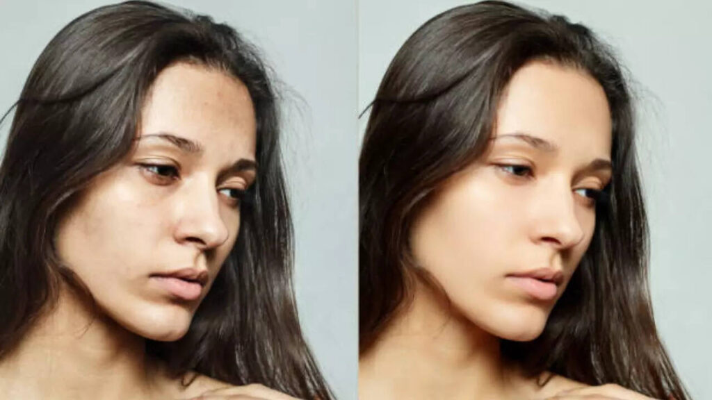 How to use Chia Seeds to remove dark spots from skin