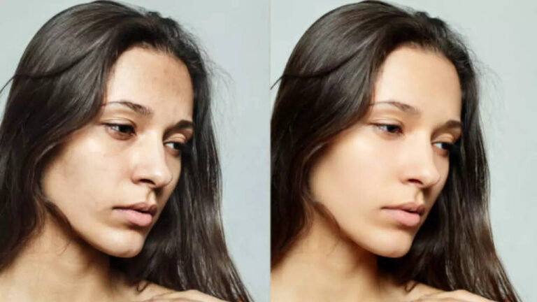 How to use Chia Seeds to remove dark spots from skin