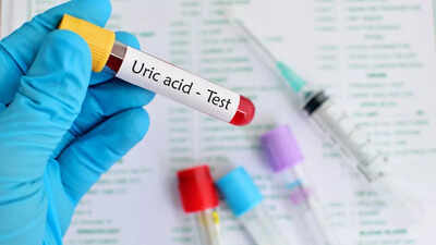 How to manage uric acid in one month: Diet and exercise tips that work |
