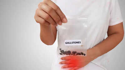 What are gallstones: How they may increase the risk of gallbladder cancer |