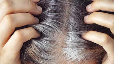 Why Indians are getting grey hair in their 20s: Causes, diet tips, and solutions |