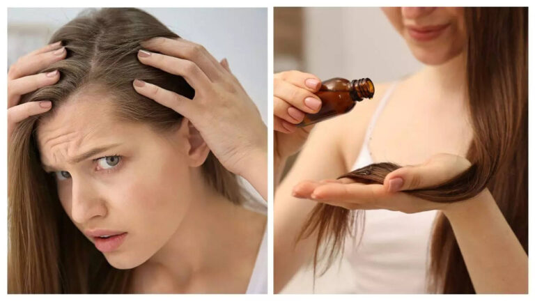 Regrow hair naturally: The secret ingredient is already in your kitchen