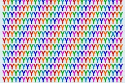Optical Illusion: Only those with high IQ can find the odd letter among the “Y’s” |