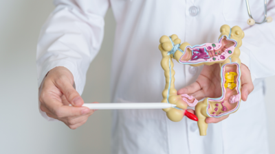 Colorectal Cancer Symptoms: 3 main reasons for its sharp rise, and early symptoms that should not be missed |