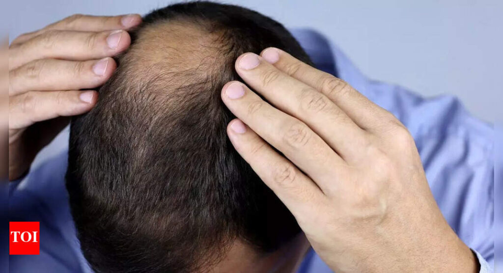 Popular hair loss treatment linked to suicide risk and mental disorders; new study warns |