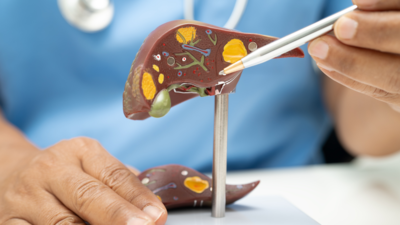 From arthritis to nausea: 6 uncommon symptoms of Fatty liver