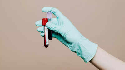 Not just cholesterol: THIS overlooked blood test can signal stroke risk