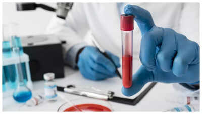 The 3 simple tests that can literally ‘save’ one’s life, as per Stanford trained doctor