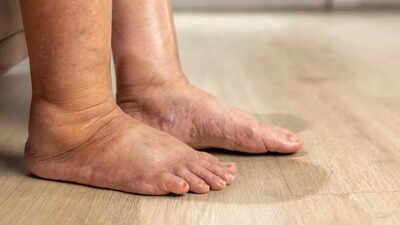 5 foot problems that could signal serious health issues |