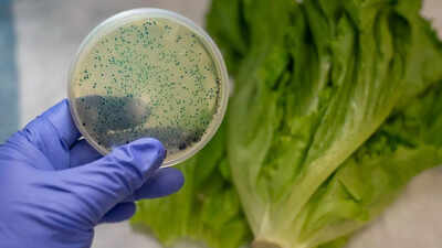 6 kitchen mistakes that could expose you to harmful E. coli and cause serious infections |