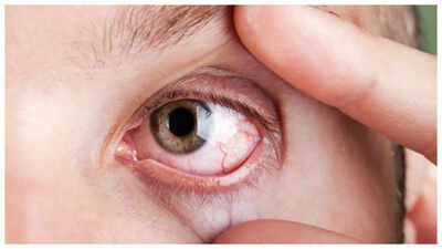 Eye Rubbing: This simple, everyday habit can damage one’s vision (and what should one do about it) |