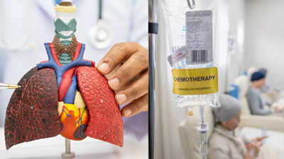 Chemotherapy for lung cancer: Know the common side effects and treatment outcomes |