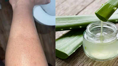 Home remedies for strawberry legs: How to smooth and care for your skin naturally |