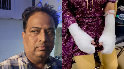 Twist in Delhi acid attack case: Woman faked assault, used toilet cleaner; father booked for rape | India News