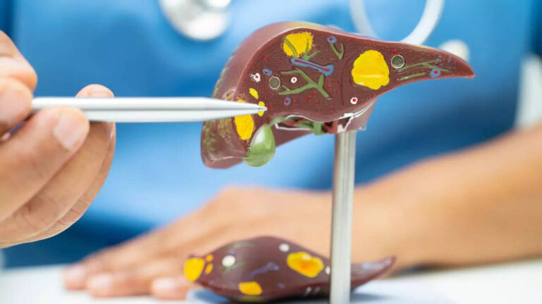 5 signs of liver damage that look like normal symptoms