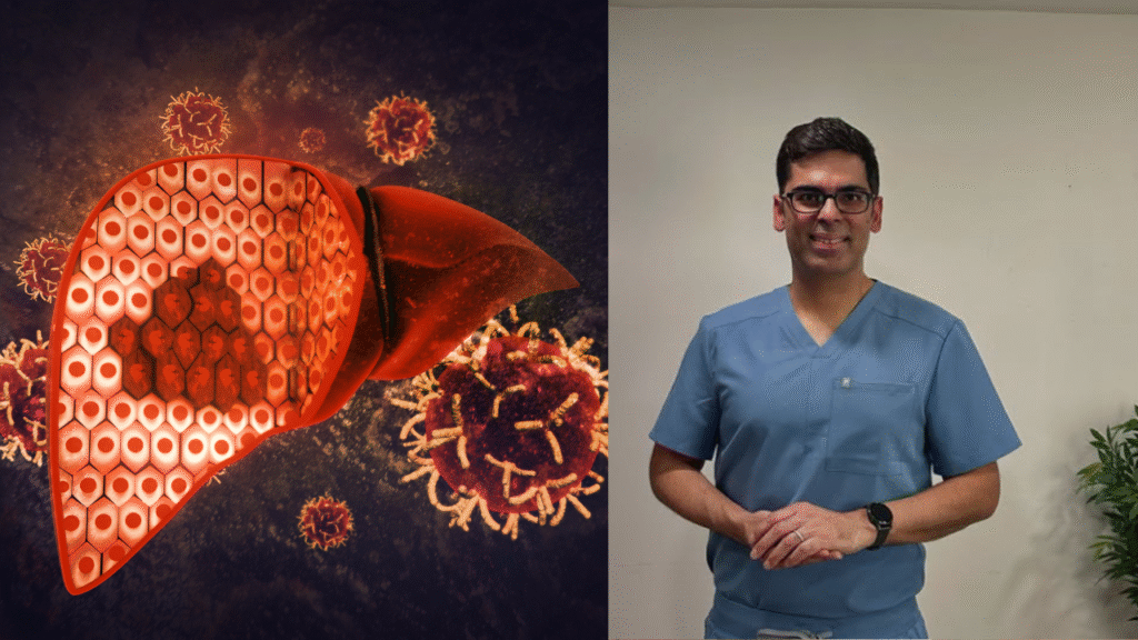 Doctor suggests 5 signs of fatty liver one can check at home