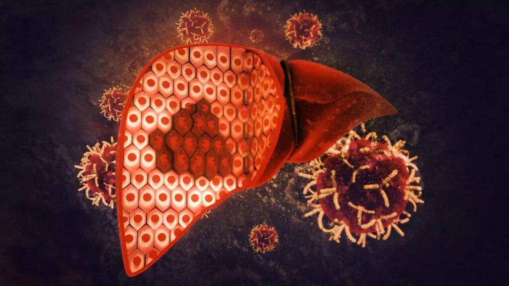 Not lack of appetite, but these are the early symptoms of this disease