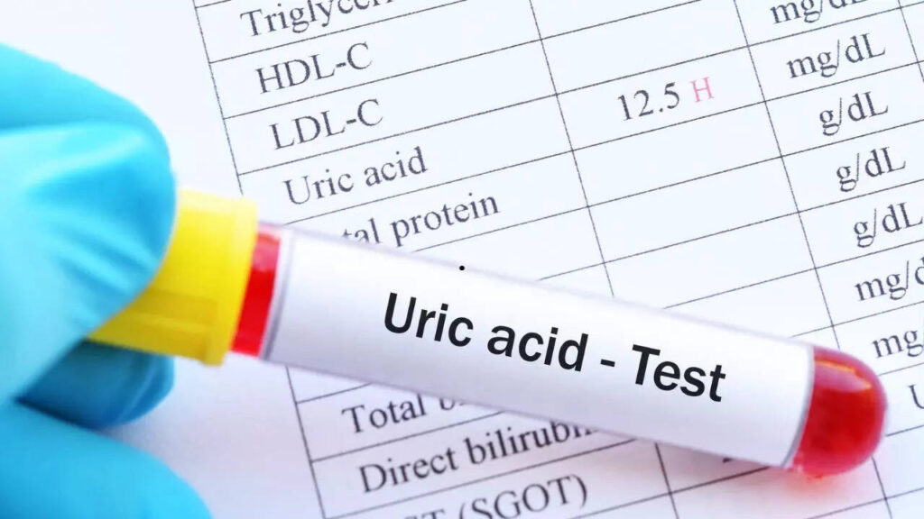7 foods that instantly lower uric acid levels