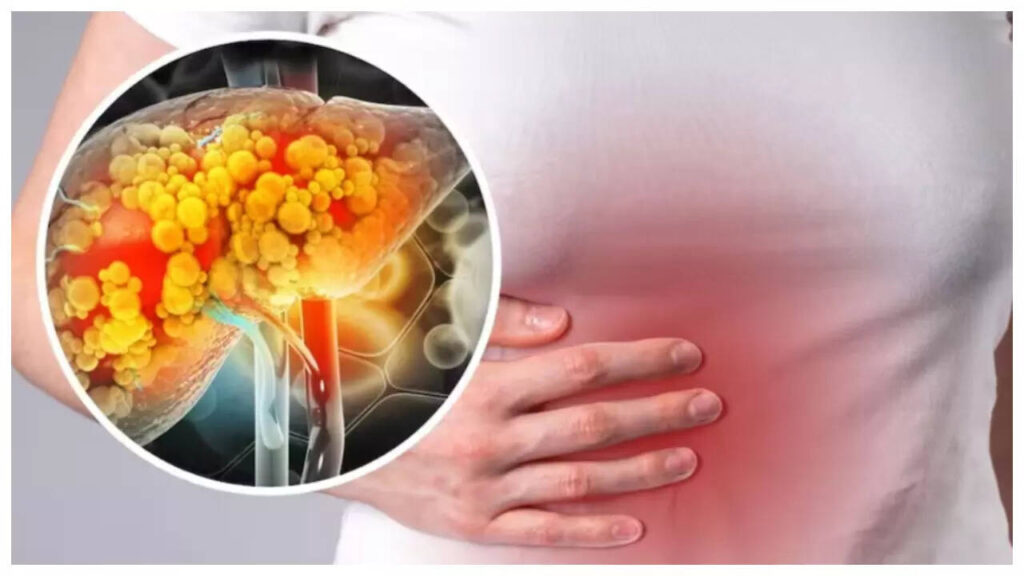 6 ‘healthy’ foods wrecking the gut, according to Harvard trained Gastroenterologist