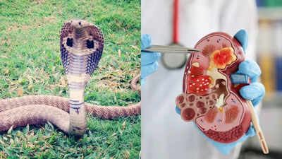 Snake urine could cure kidney stones and gout pain, scientists reveal |