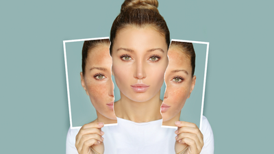 What happens to the skin and complexion if one drinks less amount of water