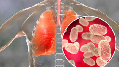 What is Diphtheria?: Once conquered bacterial infection is on the rise in children |