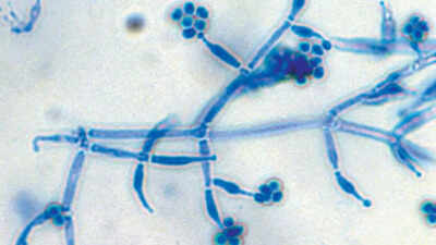 How to use Trichoderma to protect home plants from root diseases and promote better growth |