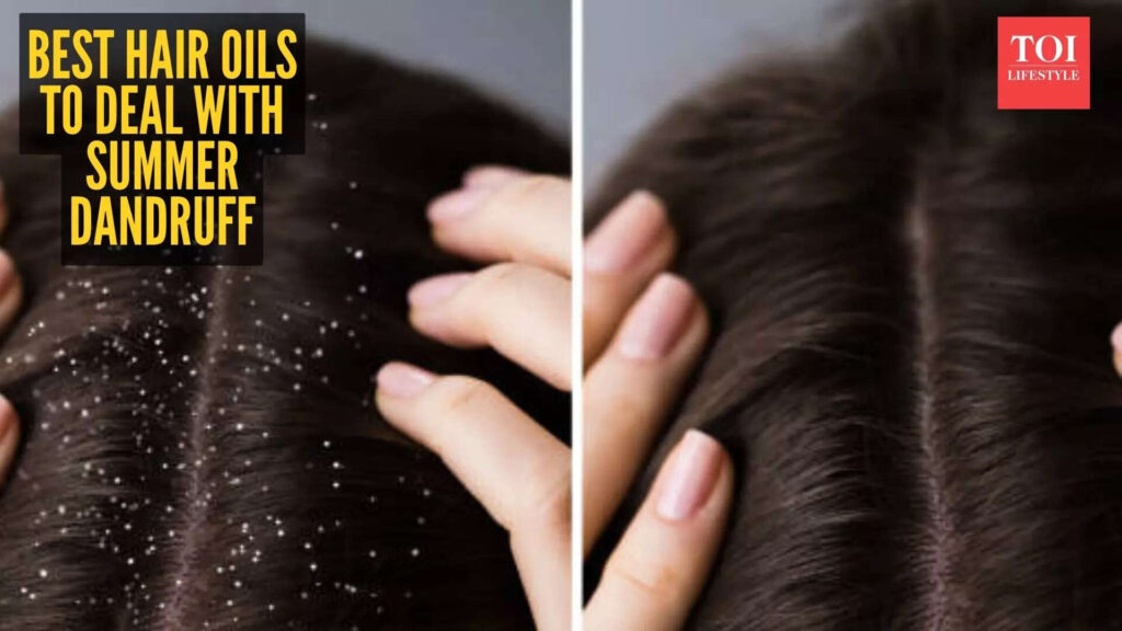 5 hair oils to beat summer dandruff