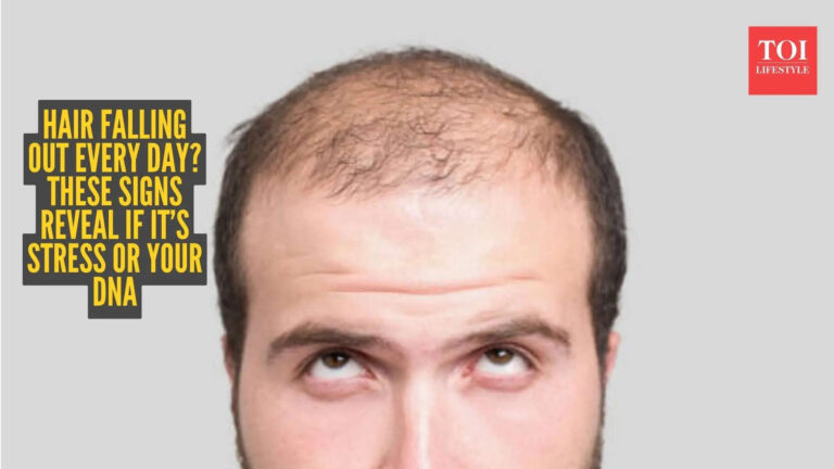 Stress or genetics? The real cause of your hair fall revealed