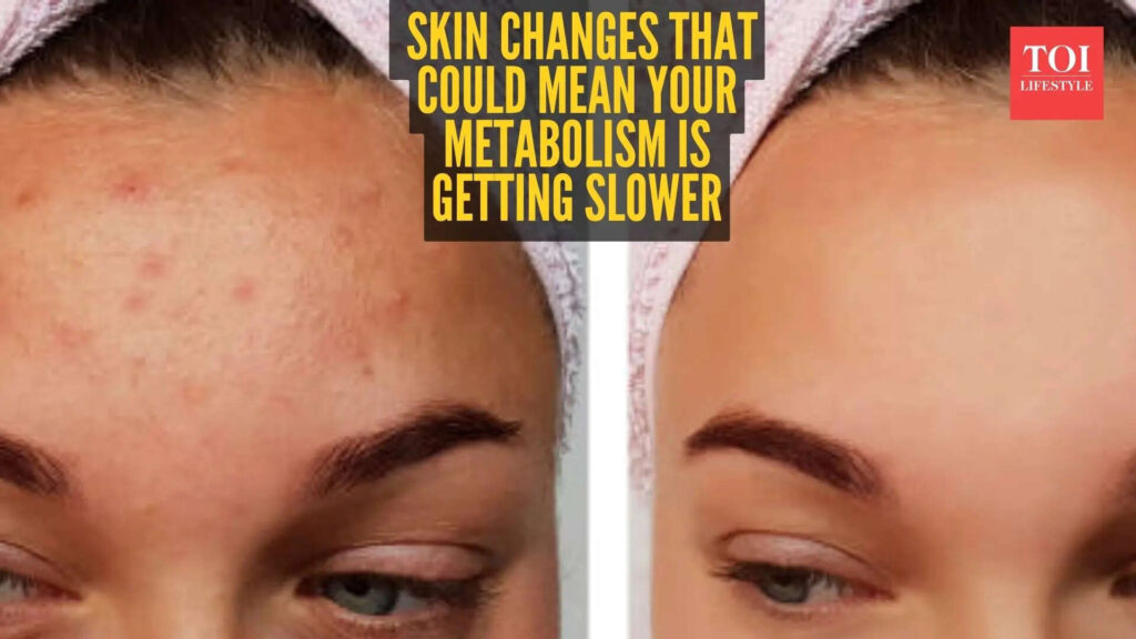 5 skin signs that your Metabolism is slowing down