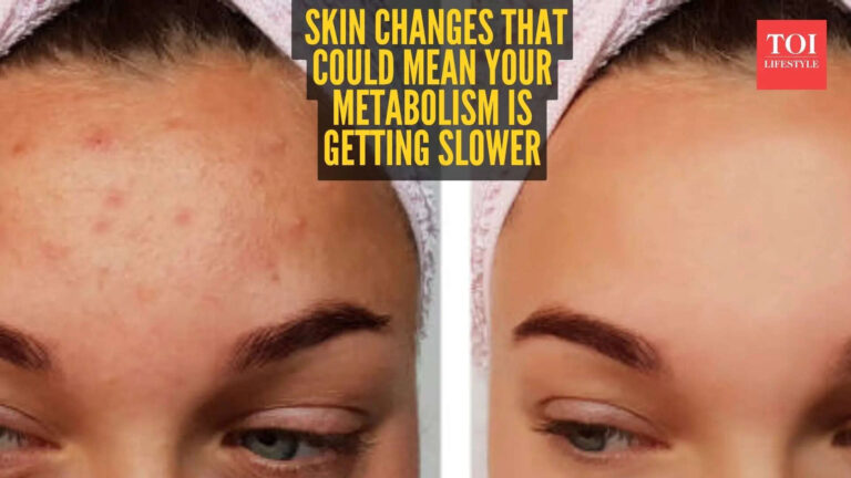 5 skin signs that your Metabolism is slowing down