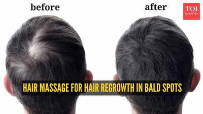 Scalp Massage For Hair Regrowth: Hair regrowth: How to do the best scalp massage for hair regrowth in bald spots